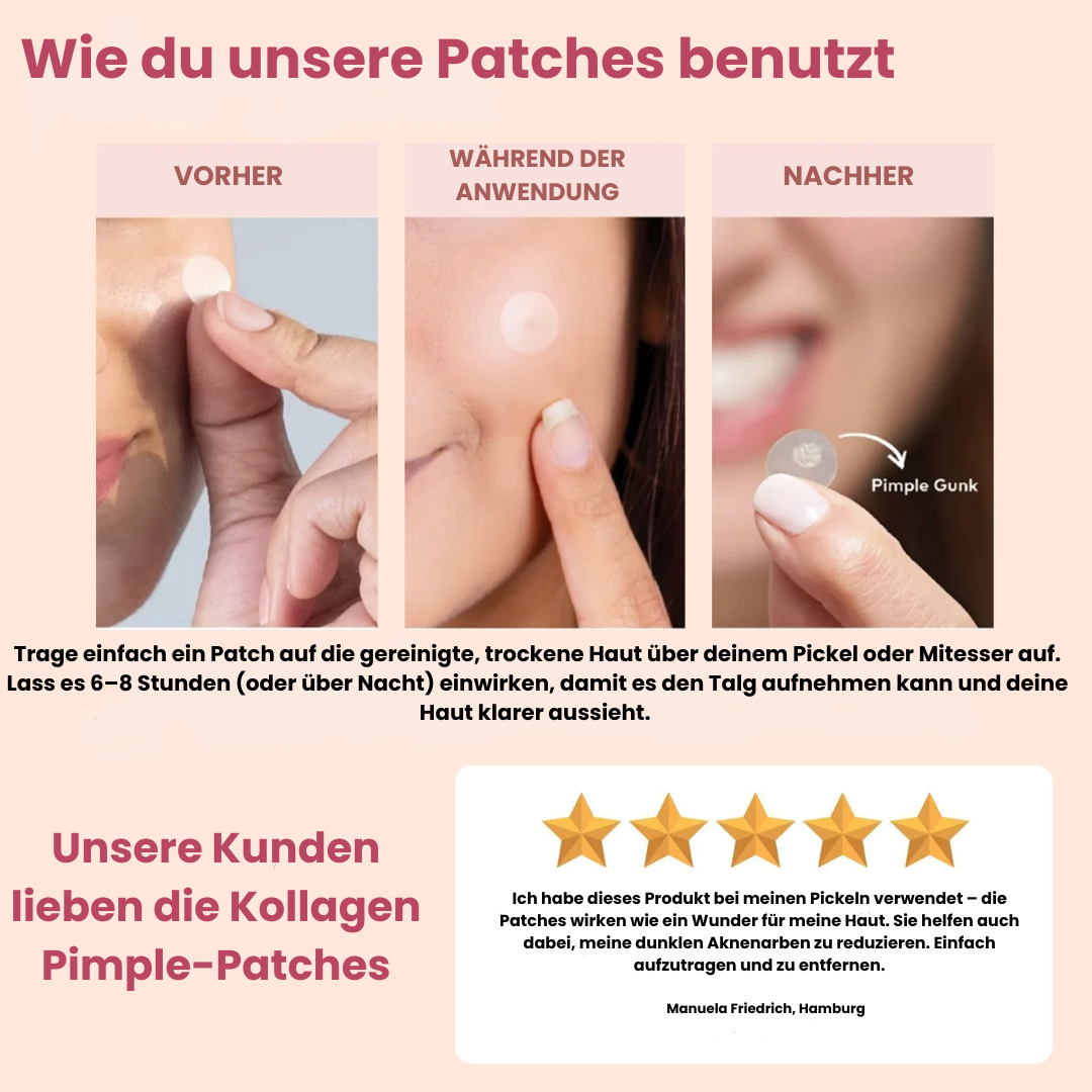 Kollagen Pimple-Patches